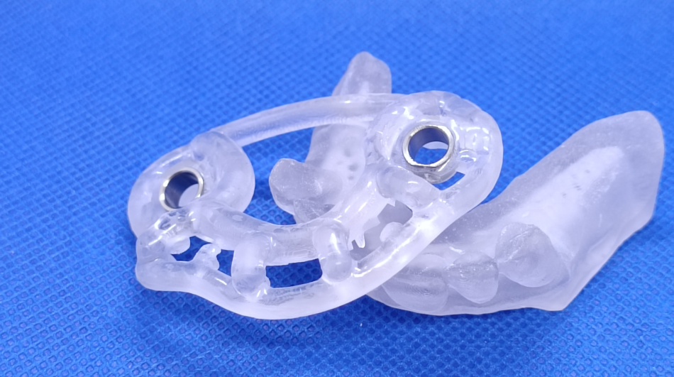 IMPIANTI DENTALI